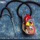 Total Flow Medical Secures FDA Clearance for Cardiopulmonary Bypass Cannula 80x80