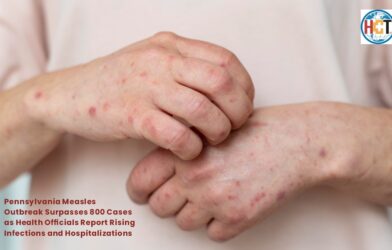 Pennsylvania Measles Outbreak Surpasses 800 Cases | Healthcare Times Magazine