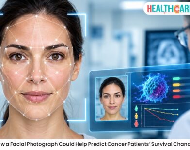 How a Facial Photograph Could Help Predict Cancer Patients’ Survival Chances